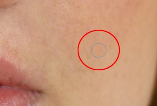 Pressing to clean the pimple