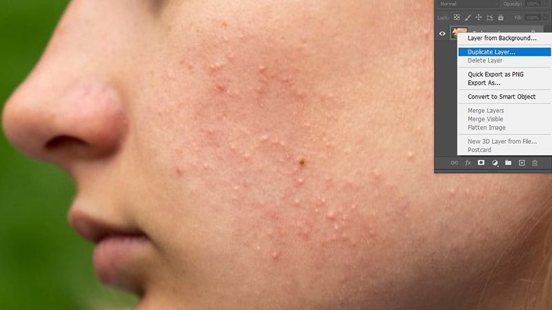 How to Remove Imperfections using Clone Stamp Tool Photoshop