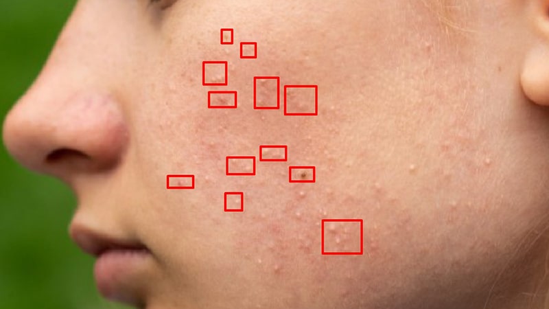 Remove Imperfections using Clone Stamp Tool Photoshop